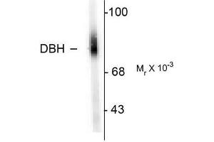 Image no. 1 for anti-Dopamine beta-Hydroxylase (Dopamine beta-Monooxygenase) (DBH) (N-Term) antibody (ABIN372612) (DBH 抗体  (N-Term))