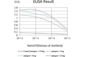 Black line: Control Antigen (100 ng),Purple line: Antigen (10 ng), Blue line: Antigen (50 ng), Red line:Antigen (100 ng) (Progesterone Receptor 抗体  (AA 166-411))
