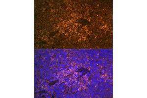 Immunohistochemistry of paraffin-embedded human esophagus using S100 Rabbit pAb (ABIN6129321, ABIN6147336, ABIN6147338 and ABIN6220958) at dilution of 1:350 (40x lens). (S100A12 抗体  (AA 1-92))