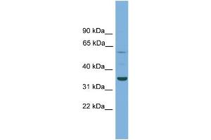 WB Suggested Anti-C3orf67 Antibody Titration: 0. (C3orf67 抗体  (N-Term))