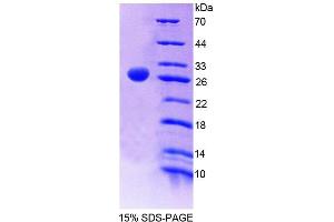 SDS-PAGE analysis of Human SRSF1 Protein. (SRSF1 蛋白)