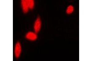 Immunofluorescent analysis of hnRNP E2 staining in MCF7 cells.
