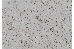 ABIN6265843 and ABIN6277620 at 1/100 staining Human kidney tissue by IHC-P. (UBE2C 抗体  (C-Term))