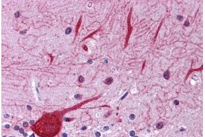 Human Brain, Cerebellum: Formalin-Fixed, Paraffin-Embedded (FFPE) (EIF2AK1 抗体  (AA 108-157))