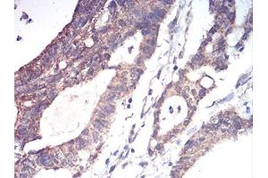 Immunohistochemistry (IHC) image for anti-Aldehyde Dehydrogenase 6 Family, Member A1 (ALDH6A1) (AA 1-195) antibody (ABIN5856297) (ALDH6A1 抗体  (AA 1-195))