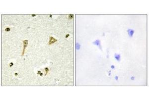 Immunohistochemistry (IHC) image for anti-TSC22 Domain Family, Member 1 (TSC22D1) (N-Term) antibody (ABIN1849646) (TSC22D1 抗体  (N-Term))