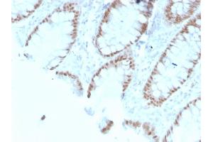 Formalin-fixed, paraffin-embedded human Colon stained with CDX2 Mouse Monoclonal Antibody (rCDX2/1690). (Recombinant CDX2 抗体  (AA 150-249))