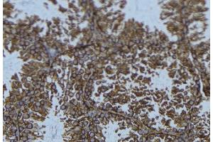 ABIN6276429 at 1/100 staining Mouse testis tissue by IHC-P. (SNX9 抗体  (Internal Region))