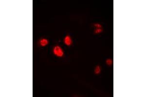 Immunofluorescent analysis of HEN1/2 staining in HEK293T cells. (HEN1/2 (Center) 抗体)