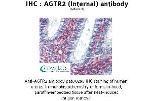 Image no. 2 for anti-Angiotensin II Receptor, Type 2 (AGTR2) (Internal Region) antibody (ABIN1731612) (Angiotensin II Type 2 Receptor 抗体  (Internal Region))