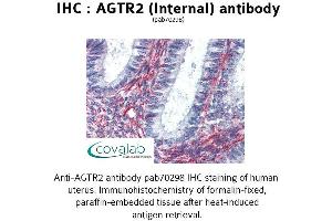 Image no. 2 for anti-Angiotensin II Receptor, Type 2 (AGTR2) (Internal Region) antibody (ABIN1731612)