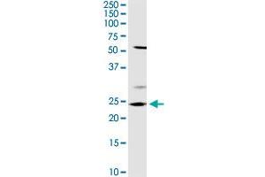 Western Blotting (WB) image for anti-OTU Domain, Ubiquitin Aldehyde Binding 2 (OTUB2) (AA 1-234) antibody (ABIN949625)