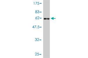 Western Blot detection against Immunogen (51. (MED7 抗体  (AA 1-233))