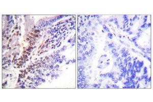 Immunohistochemistry (IHC) image for anti-GR (Internal Region), (pSer226), (pSer234), (pSer246) antibody (ABIN1847260) (GR (Internal Region), (pSer226), (pSer234), (pSer246) 抗体)