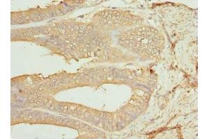 Immunohistochemistry (IHC) image for anti-Casein Kinase 1, gamma 1 (CSNK1G1) (AA 298-422), (Isoform gamma 1) antibody (ABIN7146875)