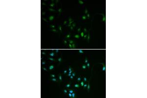 Immunofluorescence analysis of MCF7 cell using BCL2 antibody.