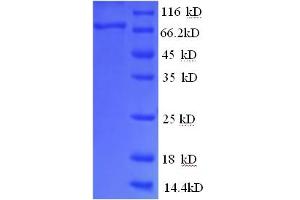 SDS-PAGE (SDS) image for Colony Stimulating Factor 1 Receptor (CSF1R) (AA 20-514), (Extracellular) protein (His-SUMO Tag) (ABIN5709335)
