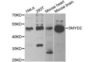 Western blot analysis of extracts of various cell lines, using SMYD2 antibody. (SMYD2A 抗体)