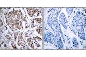 Immunohistochemistry (IHC) image for anti-BCL2-Associated Agonist of Cell Death (BAD) (AA 119-168), (pSer118) antibody (ABIN1531780)