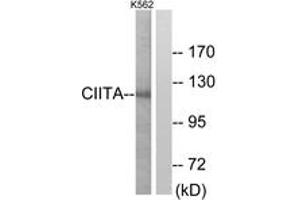 Western blot analysis of extracts from K562 cells, using CIITA Antibody. (CIITA 抗体  (AA 706-755))