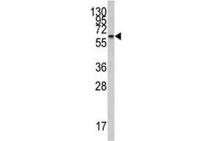Western Blotting (WB) image for anti-Cytochrome P450, Family 26, Subfamily A, Polypeptide 1 (CYP26A1) (AA 118-147) antibody (ABIN3030690)