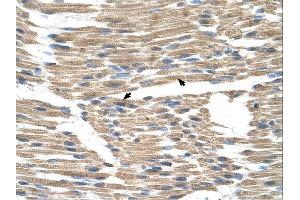 Immunohistochemistry (IHC) image for anti-Wntless Homolog (WLS) (N-Term) antibody (ABIN2781859) (GPR177/WLS 抗体  (N-Term))