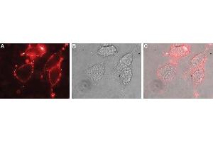 Immunocytochemistry (ICC) image for anti-Solute Carrier Family 4, Sodium Bicarbonate Cotransporter, Member 4 (SLC4A4) (AA 672-685), (Extracellular) antibody (ABIN7043728)