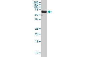 Western Blotting (WB) image for anti-3'-phosphoadenosine 5'-phosphosulfate Synthase 2 (PAPSS2) (AA 513-613) antibody (ABIN598592) (PAPSS2 抗体  (AA 513-613))