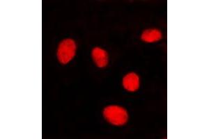 Immunofluorescent analysis of Lamin A/C staining in HeLa cells. (Lamin A/C 抗体  (Center))