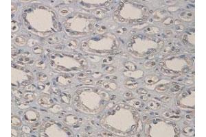 Immunohistochemical staining of formalin-fixed paraffin-embedded human kidney tissue with ADAMTS1 polyclonal antibody  at 1 : 100 dilution. (ADAMTS1 抗体  (C-Term))