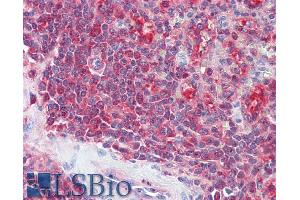 Immunohistochemistry (IHC) image for anti-Proteasome (Prosome, Macropain) Activator Subunit 2 (PA28 Beta) (PSME2) (C-Term) antibody (ABIN334467)