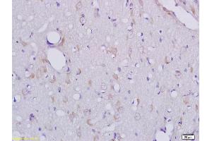 Formalin-fixed and paraffin embedded rat brain tissue labeled with Anti-CLEC1/CLEC1A Polyclonal Antibody, Unconjugated (ABIN741795) at 1:200 followed by conjugation to the secondary antibody and DAB staining