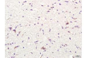 Paraformaldehyde-fixed, paraffin embedded rat brain tissue, Antigen retrieval by boiling in sodium citrate buffer(pH6) for 15min, Block endogenous peroxidase by 3% hydrogen peroxide for 30 minutes, Blocking buffer (normal goat serum) at 37°C for 20min, Antibody incubation with Rabbit Anti-CD80 Polyclonal Antibody, Unconjugated  at 1:400 overnight at 4°C, followed by a conjugated secondary and DAB staining (CD80 抗体  (AA 251-321))