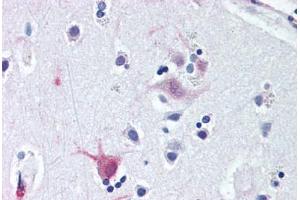 Anti-WNT8B antibody  ABIN1049486 IHC staining of human brain, cortex. (WNT8B 抗体  (C-Term))