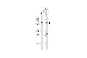 All lanes : Anti-Yes1 Antibody (Center) at 1:2000 dilution Lane 1: mouse lung lysates Lane 2: L6 whole cell lysates Lysates/proteins at 20 μg per lane. (YES1 抗体  (AA 148-182))