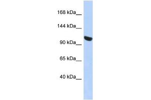 WB Suggested Anti-UBA1 Antibody Titration: 0. (UBA1 抗体  (N-Term))