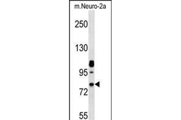 NEK8 抗体  (C-Term)