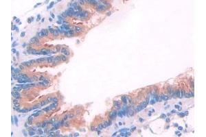 Detection of JAK2 in Rat Lung Tissue using Polyclonal Antibody to Janus Kinase 2 (JAK2)