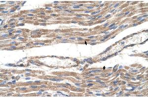 Immunohistochemistry (IHC) image for anti-Solute Carrier Family 2 (Facilitated Glucose Transporter), Member 6 (SLC2A6) (C-Term) antibody (ABIN2781653)