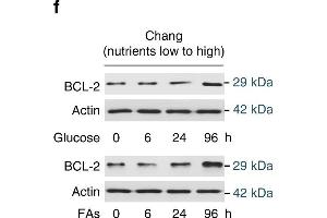 Nutrient induces apoptosis resistance. (Bcl-2 抗体)