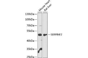 Western blot analysis of extracts of various cell lines, using SERPINF2 antibody  at 1:1000 dilution. (alpha 2 Antiplasmin 抗体  (AA 302-491))