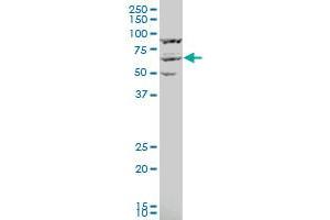 KPNA3 polyclonal antibody (A01), Lot # FAK0060120QCS1 Western Blot analysis of KPNA3 expression in IMR-32 . (KPNA3 抗体  (AA 422-521))