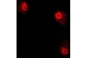 Immunofluorescent analysis of PHYH staining in U2OS cells. (PHYH 抗体)