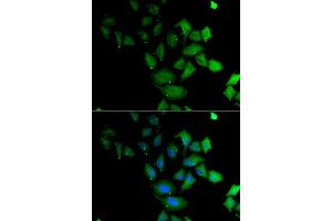 Immunofluorescence analysis of U2OS cell using PSG1 antibody. (PSG1 抗体)