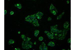 Immunofluorescent staining of HeLa cells using anti-RNF144B mouse monoclonal antibody (ABIN2453611). (RNF144B 抗体  (AA 1-256))