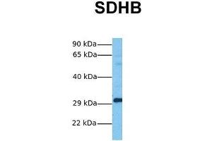 Western Blotting (WB) image for anti-Succinate Dehydrogenase Complex, Subunit B, Iron Sulfur (Ip) (SDHB) (Middle Region) antibody (ABIN2783181)