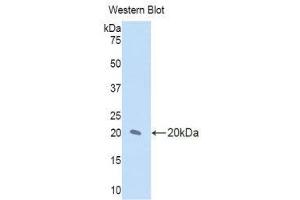 Western Blotting (WB) image for anti-Interleukin 17 Receptor D (IL17RD) (AA 157-299) antibody (ABIN1859365)