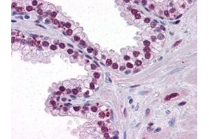 Immunohistochemical analysis of paraffin-embedded human Prostate tissues using Androgen receptor mouse mAb