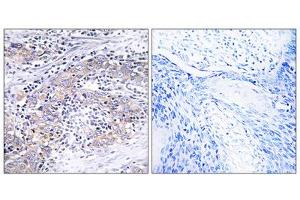 Immunohistochemistry analysis of paraffin-embedded human cervix tissue using CLN6 antibody. (CLN6 抗体  (C-Term))