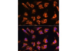 Immunofluorescence analysis of U-2 OS cells using OBSCN antibody (ABIN7269076) at dilution of 1:100. (Obscurin 抗体)